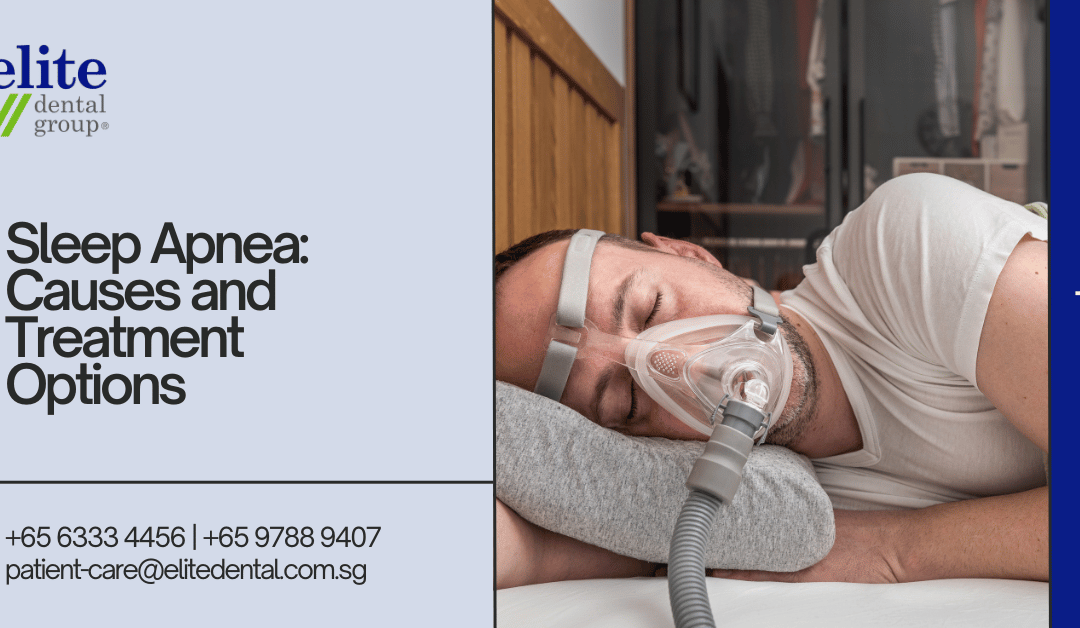 Sleep Apnea: Causes and Treatment Options - Elite Dental Group