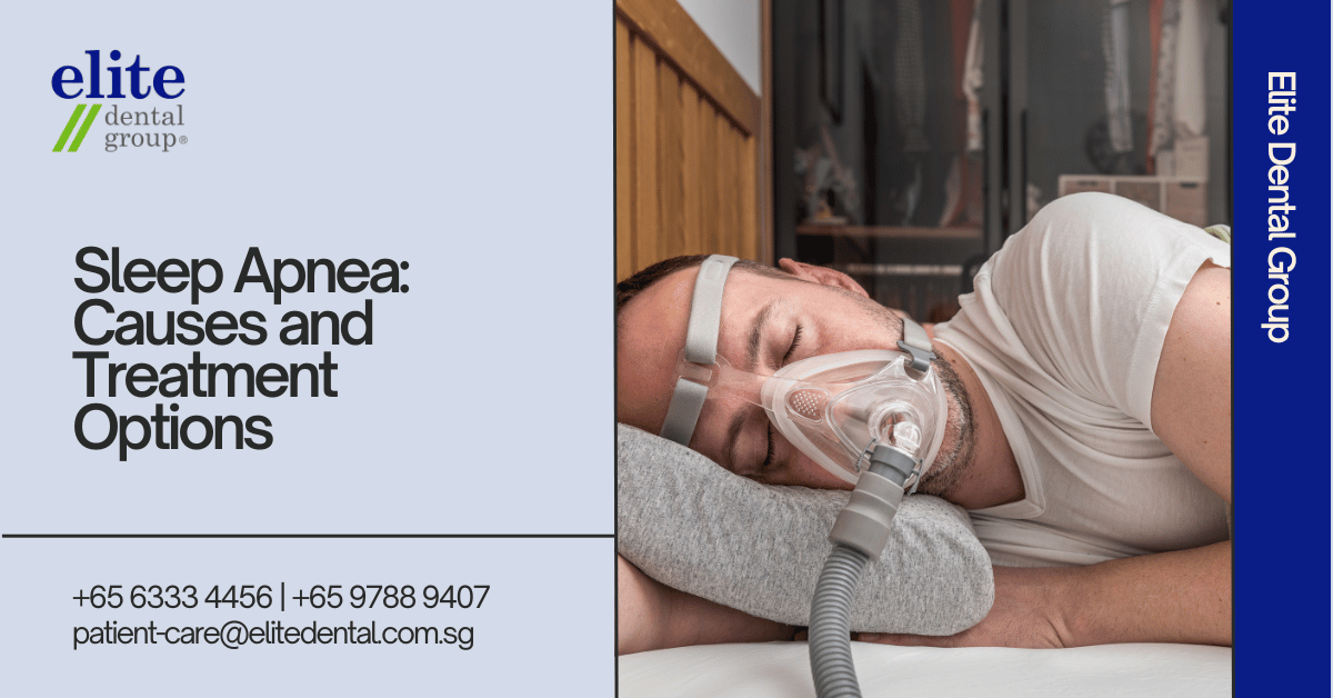 Sleep Apnea: Causes and Treatment Options - Elite Dental Group