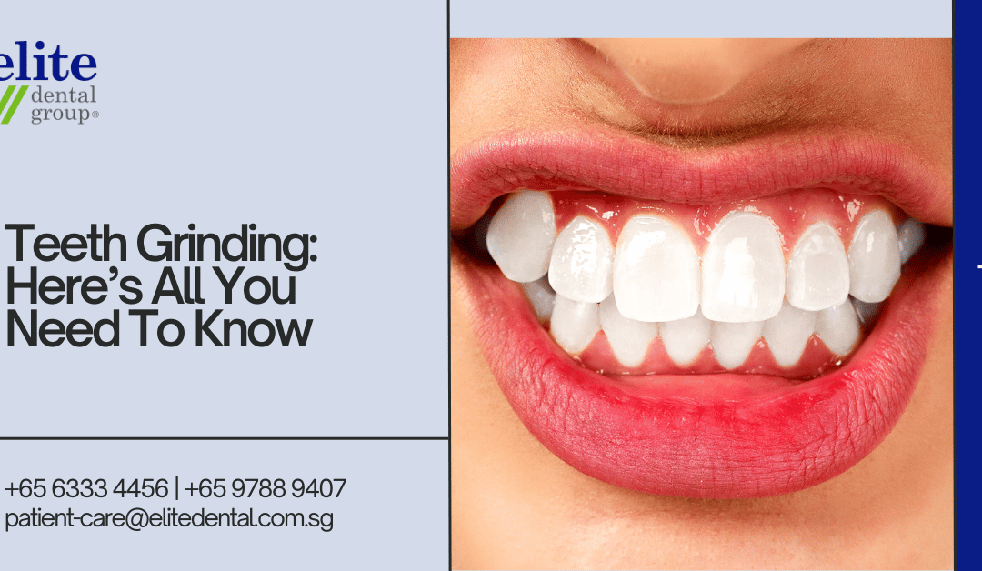 Teeth Grinding: Here's All You Need To Know - Elite Dental Group