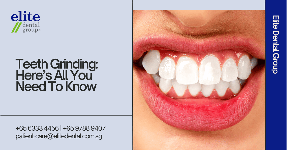 Teeth Grinding: Here's All You Need To Know - Elite Dental Group