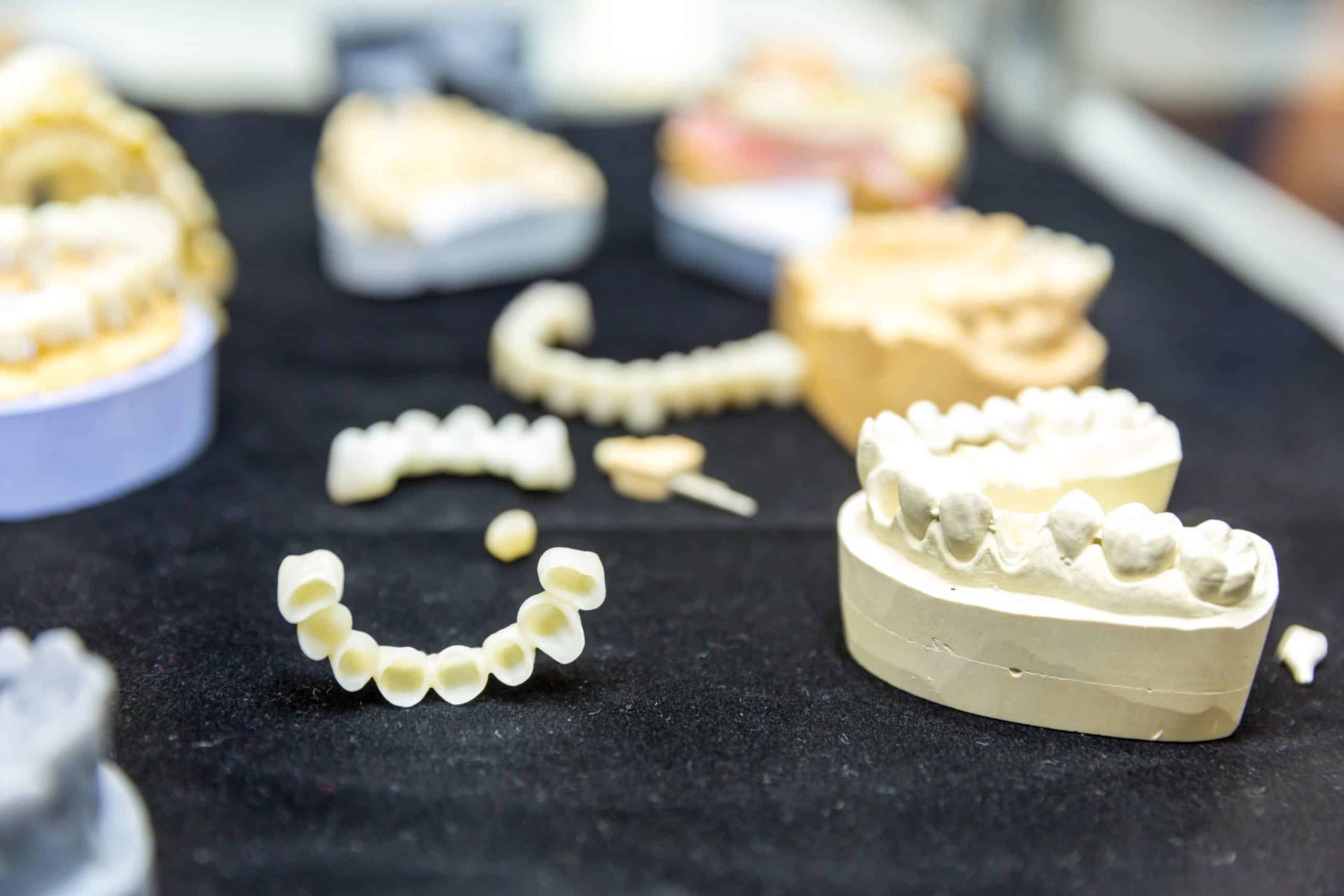 dental implant Singapore