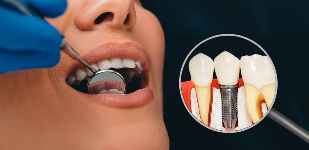 dental surgeon in Singapore