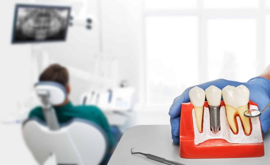 dental implant surgeon in Singapore