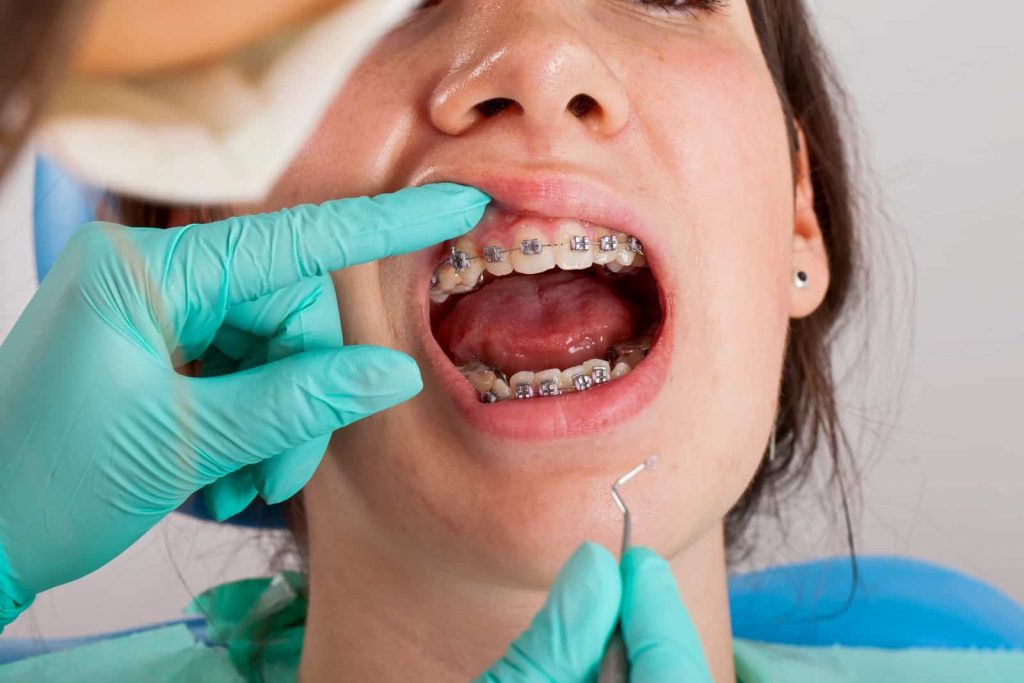 dental implant surgeon in Singapore