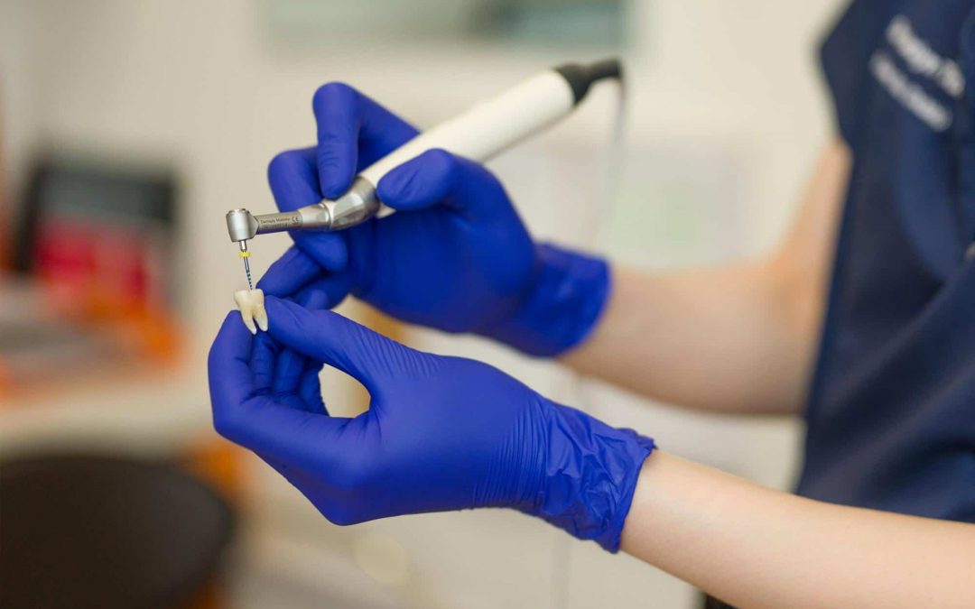 Is Root Canal Treatment Painful?