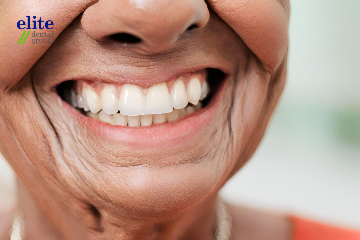 Single tooth implant on a lady resulting in a confident smile.