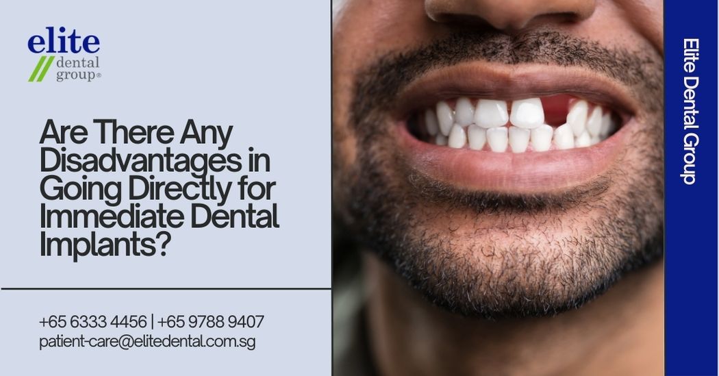 Are There Any Disadvantages in Going Directly for Immediate Dental Implants?