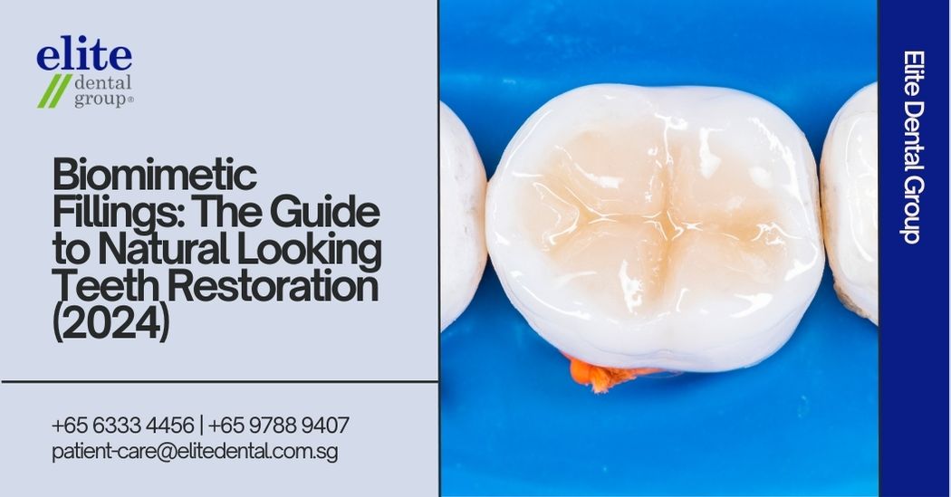 Biomimetic Fillings: The Guide to Natural Looking Teeth Restoration (2024)
