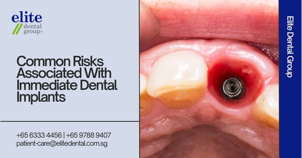 Common Risks Associated with Immediate Dental Implants