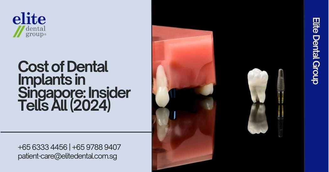 Costs of Dental Implants In Singapore: Insider Tells All! (2024)