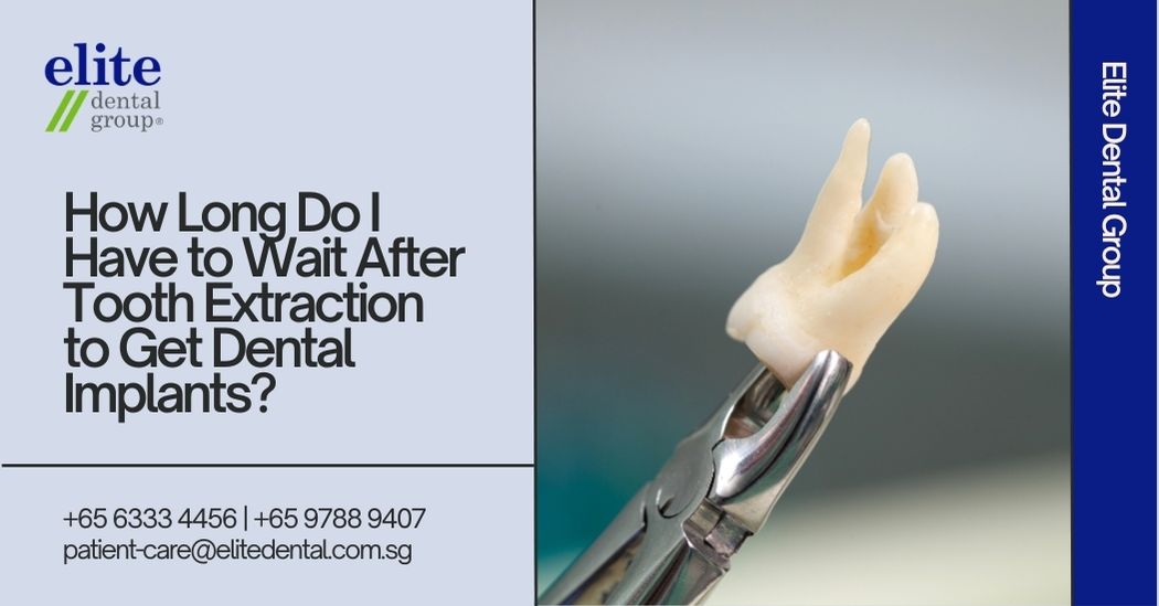 How Long Do I Have to Wait After Tooth Extraction to Get Dental Implants?