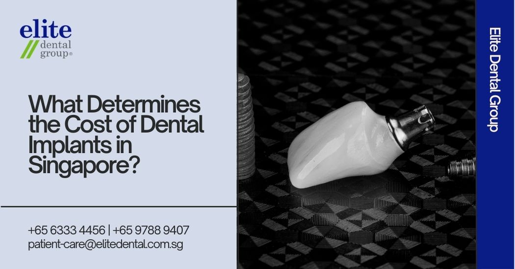What Determines the Cost of Dental Implants in Singapore?