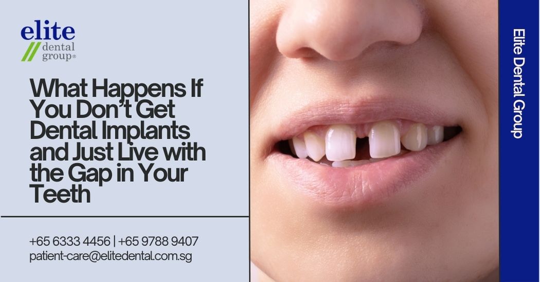 What Happens If You Don’t Get Dental Implants and Just Live with the Gap in Your Teeth