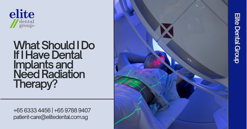 What Should I Do If I Have Dental Implants and Need Radiation Therapy?